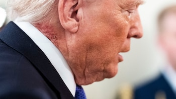 ¿Qué es esa erupción en