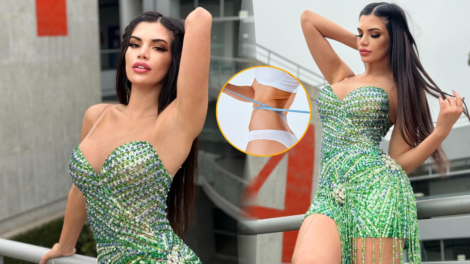 Samantha Batallanos sorprende al someterse a cirugía de luxación de costillas para reducir su cintura. (Captura: El Reventonazo de la Chola)