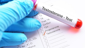 La testosterona alta aumenta el riesgo de trastorno del ritmo cardíaco, según una revisión