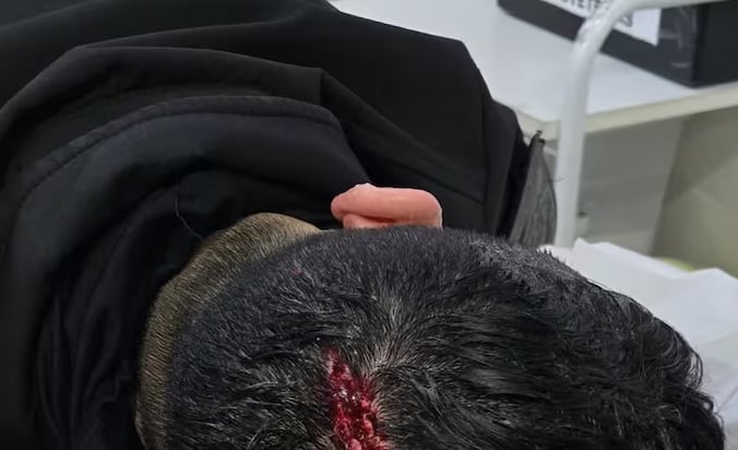 Los agentes fueron trasladados al hospital local, donde les diagnosticaron politraumatismos a raíz de los golpes recibidos