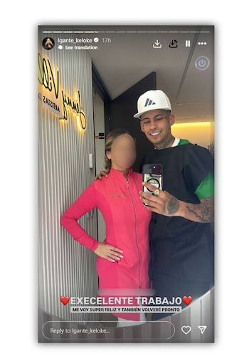 LGante se cambió la dentadura