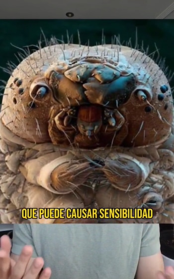 El ácaro demodex puede causar