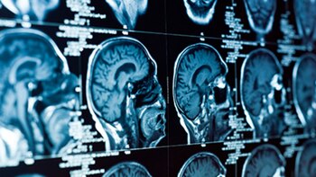 El estudio publicado en la