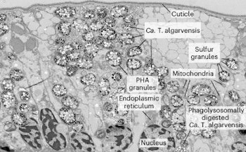 Micrografía electrónica con cutícula, bacteria Ca. T. algarvensis, gránulos de azufre y PHA, mitocondrias, retículo endoplasmático y núcleo