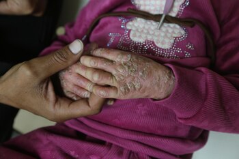 Imagen URLDTBDVCJFJDCBMYVTFFZICXY