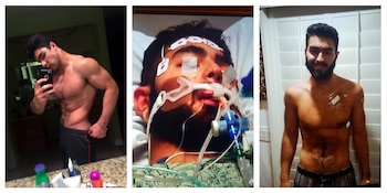 En EEUU se detectaron casos