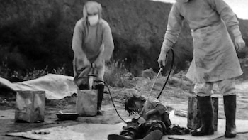 Amputaciones sin anestesia, experimentos con