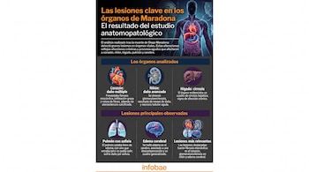 Infografía muestra un cuerpo humano y detalles de lesiones en sus órganos vitales: corazón, riñón, hígado, pulmones y cerebro, con descripciones textuales.