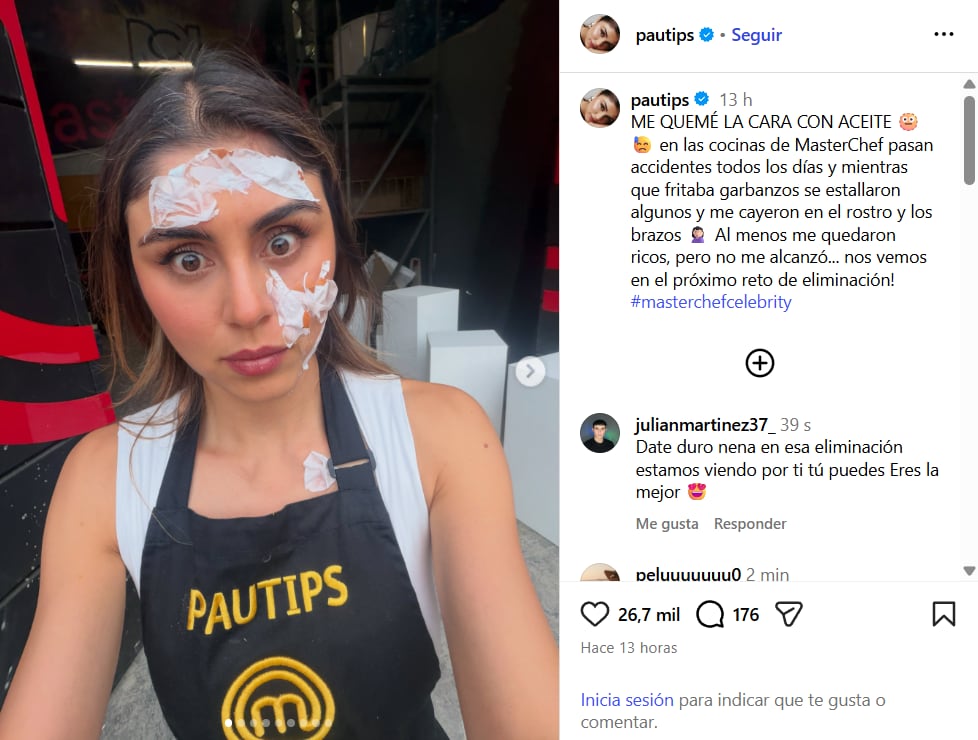 Pautips mostró cómo se quemó el rostro tras un accidente en 'MasterChef Celebrity' con unos garbanzos - crédito @pautips/IG