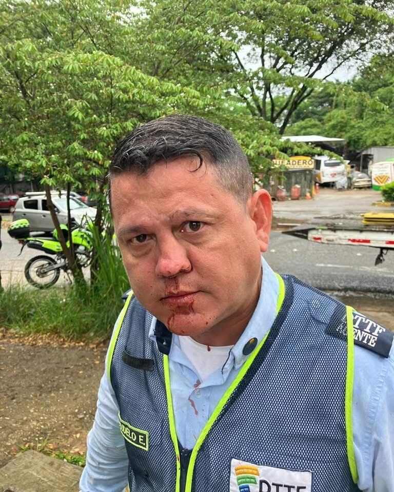 El agente de tránsito afectado muestra las lesiones en su rostro, presuntamente causadas por cabezazos del director de Tránsito de Floridablanca, según su denuncia - crédito red social Facebook