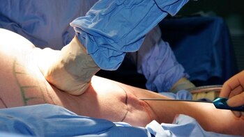 Cuando los familiares ingresaron al