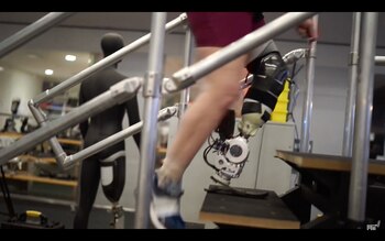 Las nuevas prótesis biónicas se