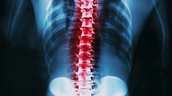 Al levantarse de la cama