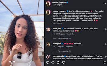 Connie Chaparro começou a chorar quando disse que o melanoma foi encontrado localmente. Foto: IG.