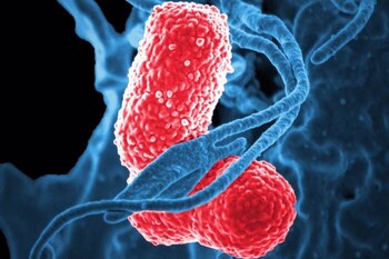 Un estudio genómico de 'Klebsiella