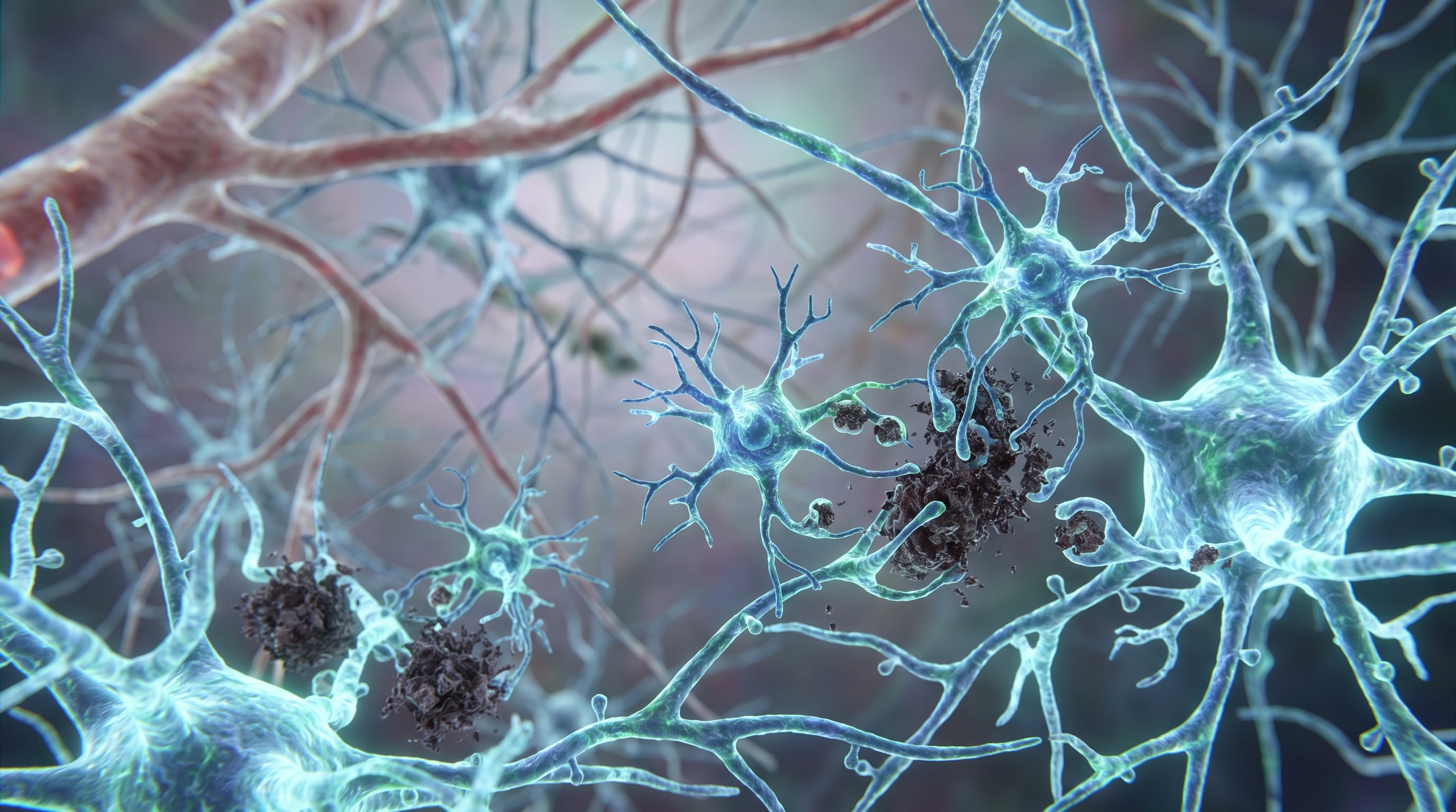 Un render biomédico muestra células de microglía rodeando y engullendo depósitos de proteína entre neuronas y vasos sanguíneos cerebrales, representando su función en la enfermedad de Alzheimer. (Imagen Ilustrativa Infobae)