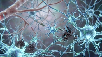 Imagen microscópica del cerebro con neuronas ramificadas, células de microglía capturando depósitos de proteína y vasos sanguíneos.