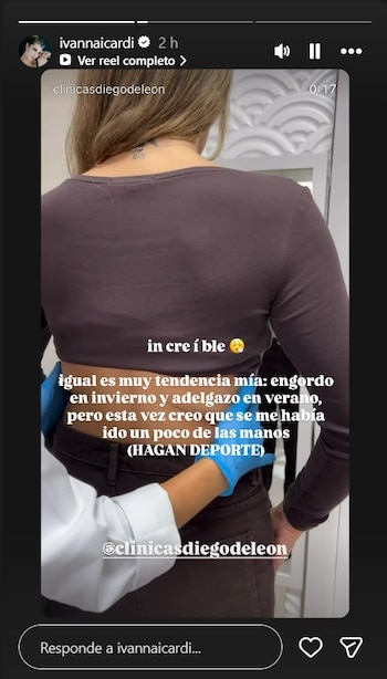 Ivana Icardi detalló que el aumento de peso y volumen en los últimos meses la llevó a buscar una solución quirúrgica