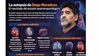 Juicio por la muerte de Maradona: un testigo dijo que su corazón tenía signos de agonía y que el edema “venía hace tiempo”