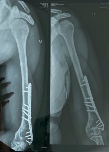 Génesis Tapia denuncia a Latina.