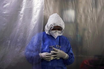 La persona requirió un respirador