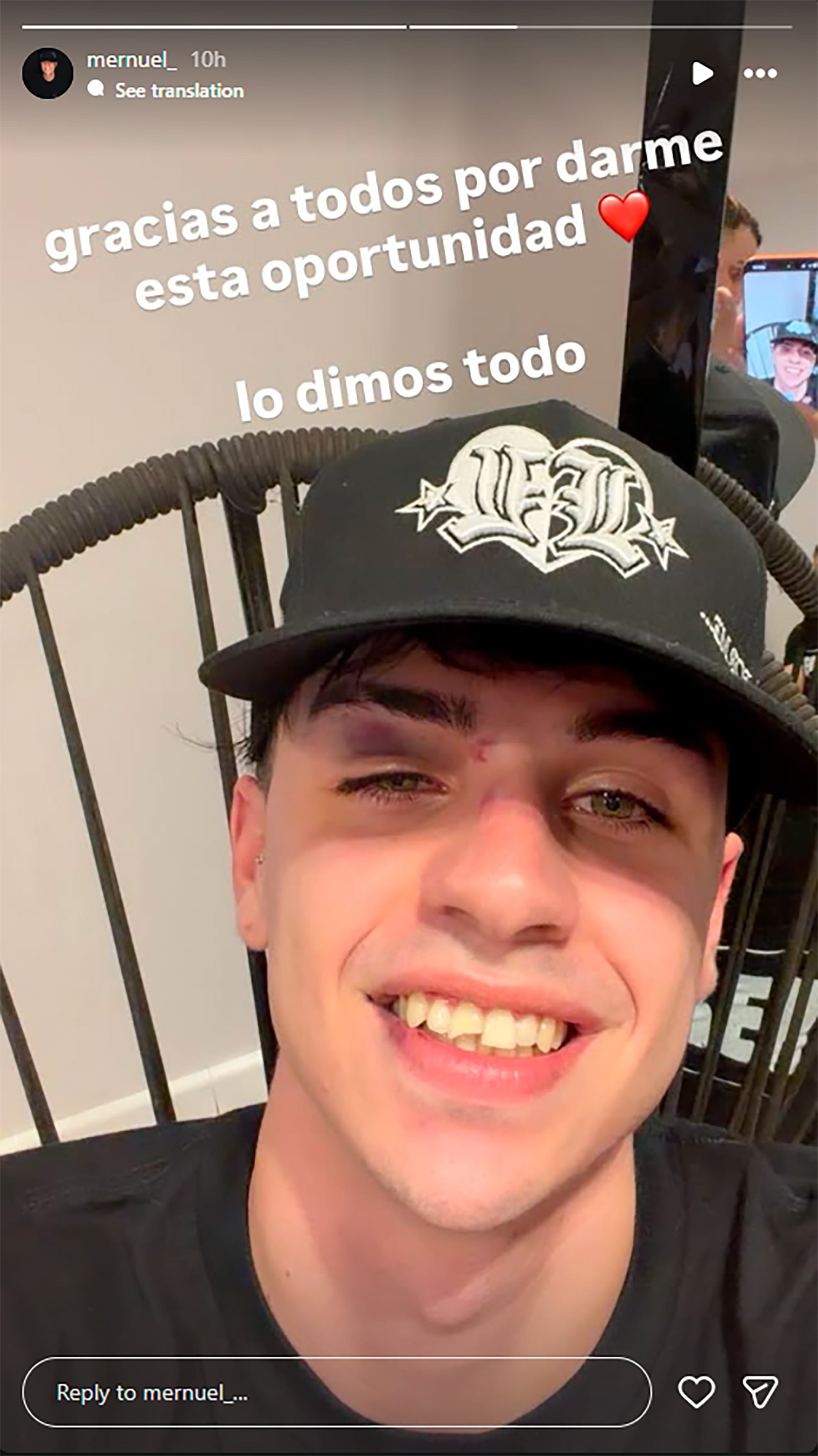 El streamer mostró cómo quedó su diente luego de perder la pelea (Instagram)