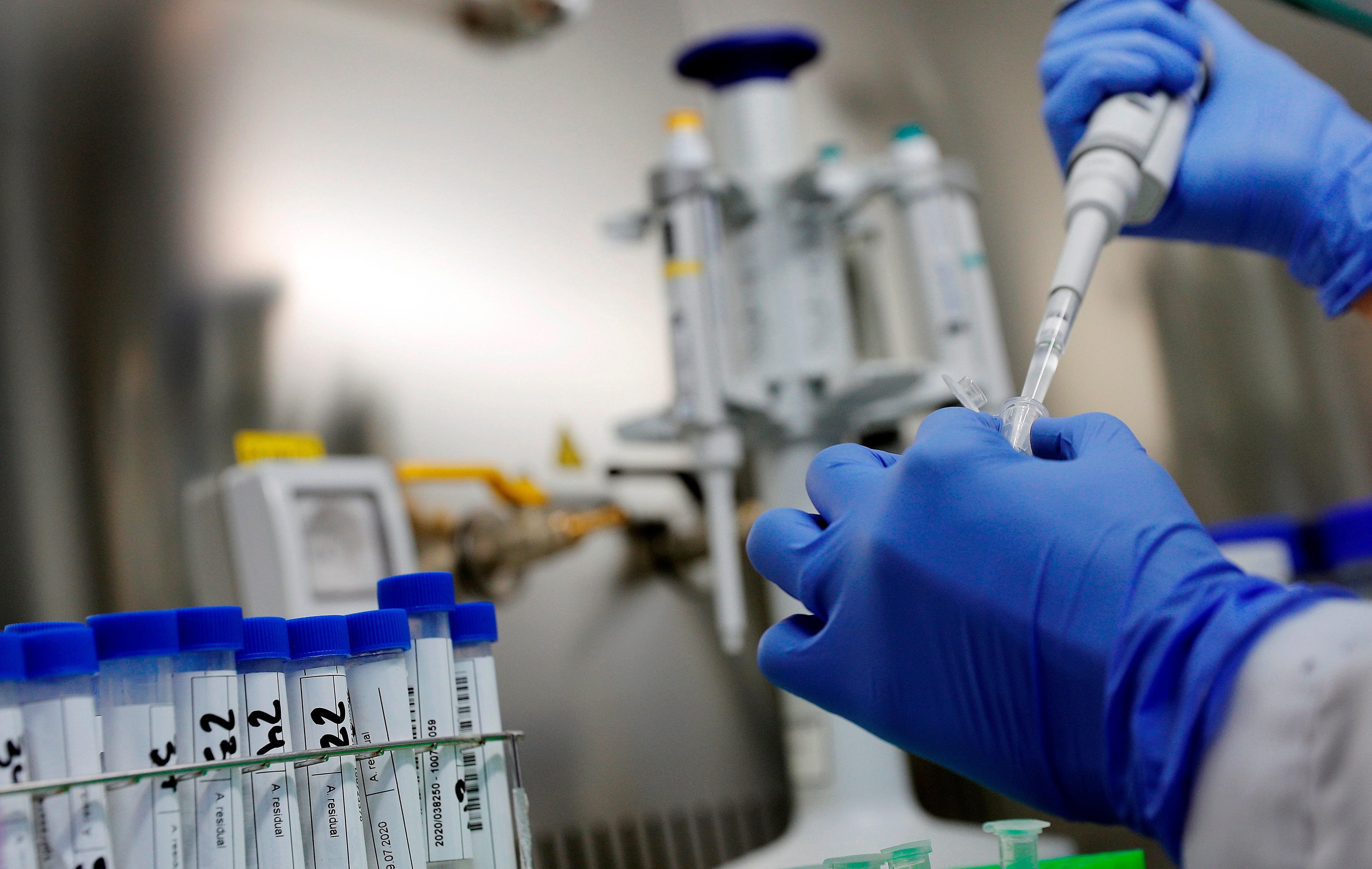 El virus Nipah fue detectado por primera vez en 1998 durante un brote entre criadores de cerdos en Malasia y Singapur (Efe)