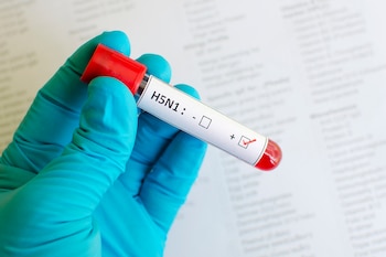 El virus de la gripe