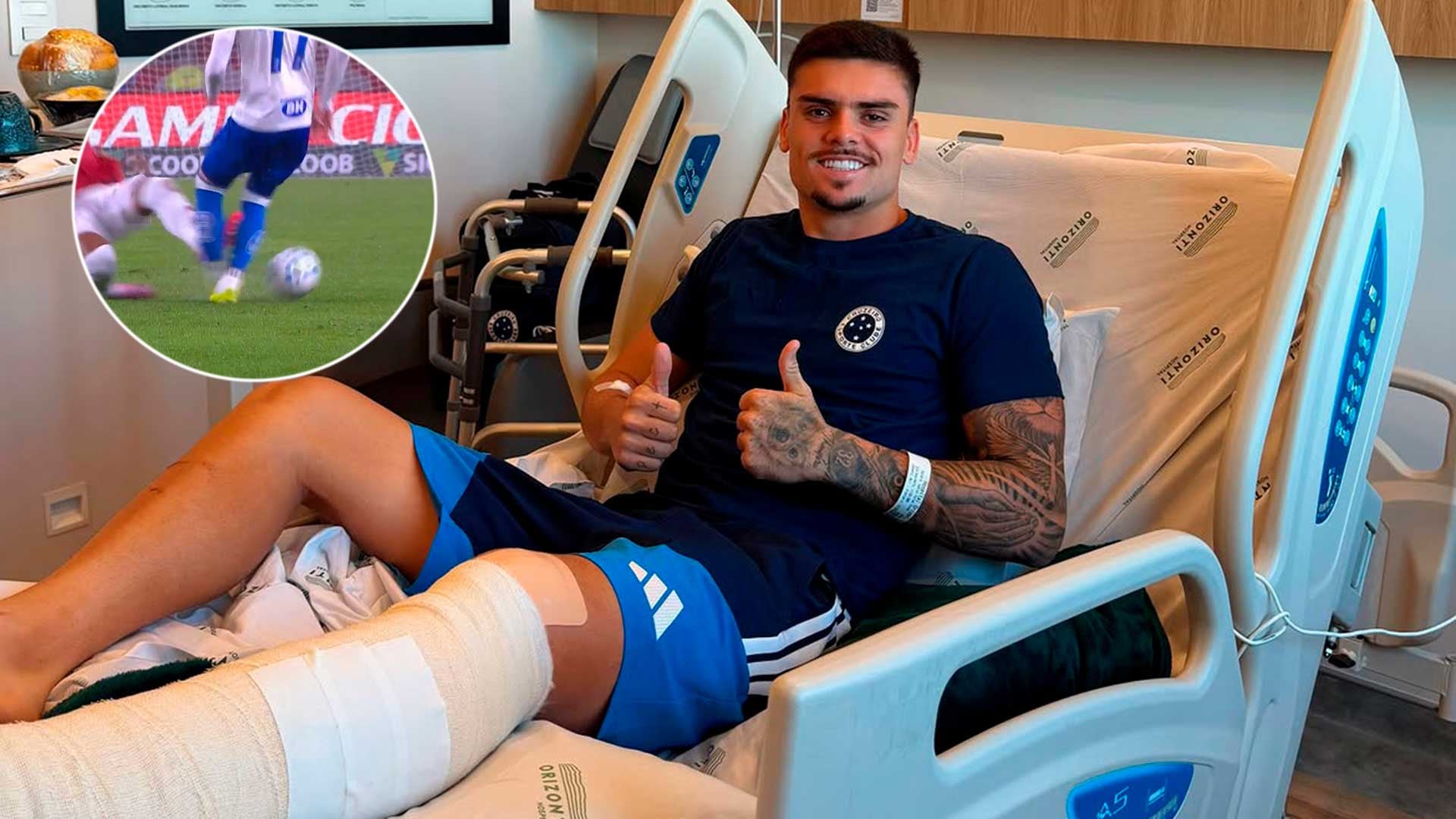 Histórica sanción en Brasil: le fracturó la pierna y no volverá a jugar hasta que su rival se recupere