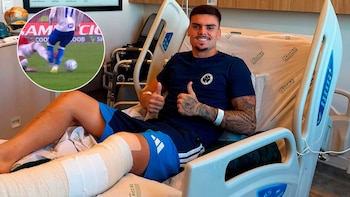 Histórica sanción en Brasil: le fracturó la pierna y no volverá a jugar hasta que su rival se recupere