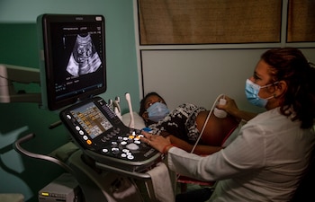 Una doctora realiza una ecografía a una paciente embarazada en el Centro de Maternidad Leonor Pérez en La Habana, Cuba (AP Foto/Ismael Francisco/Archivo)