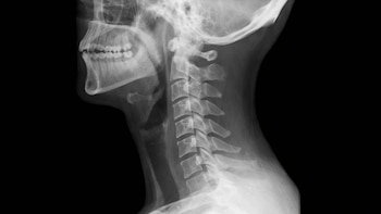 Cuál es la tecnología usada para detectar objetos extraños en la garganta y otras partes del cuerpo humano