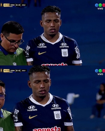 Cristian Carbajal salió lesionado en