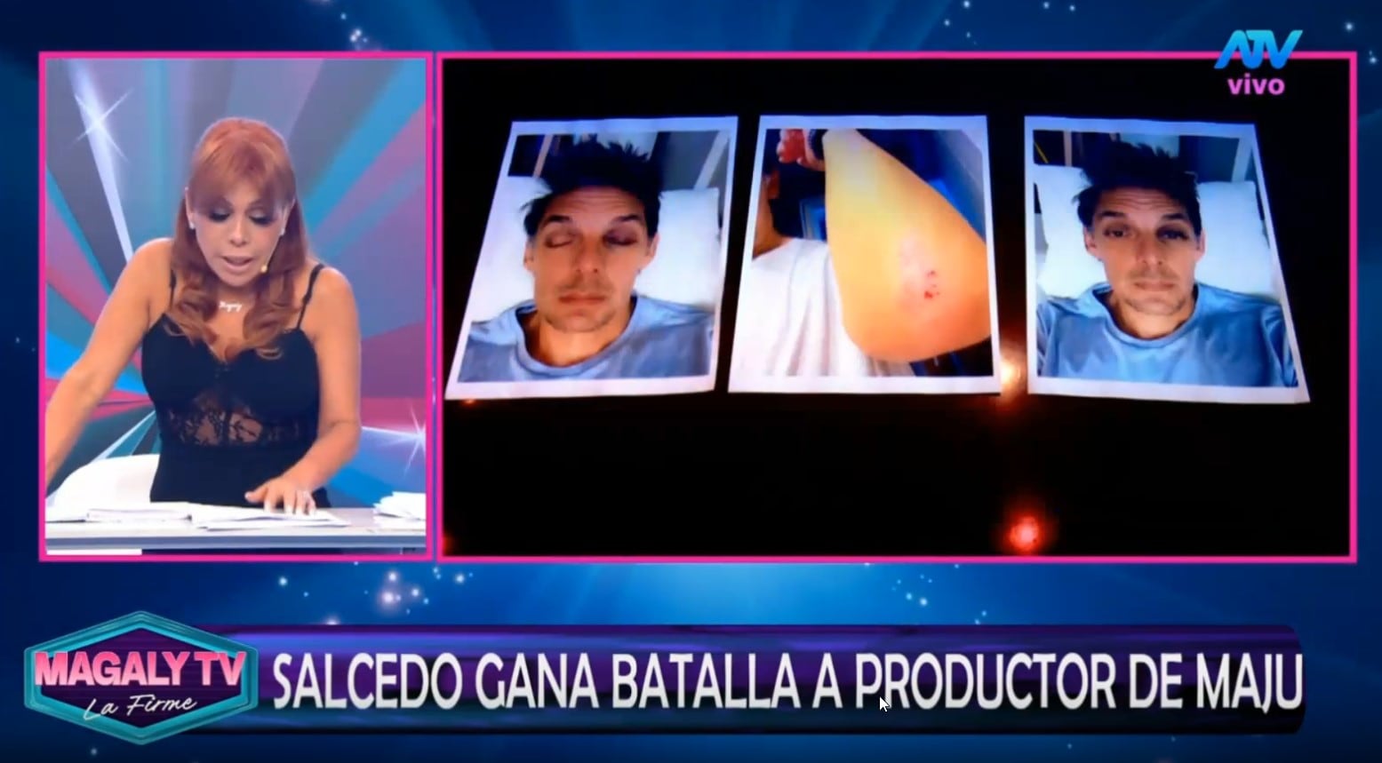 Gustavo Salcedo: Fiscalía dispone archivo de denuncia por presunto reglaje, acoso y homicidio en grado de tentativa. Captura: Magaly TV La Firme.