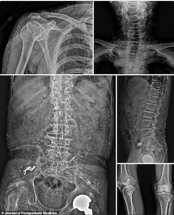 En 2022, un hombre coreano