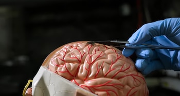 El chip ultradelgado va colocado