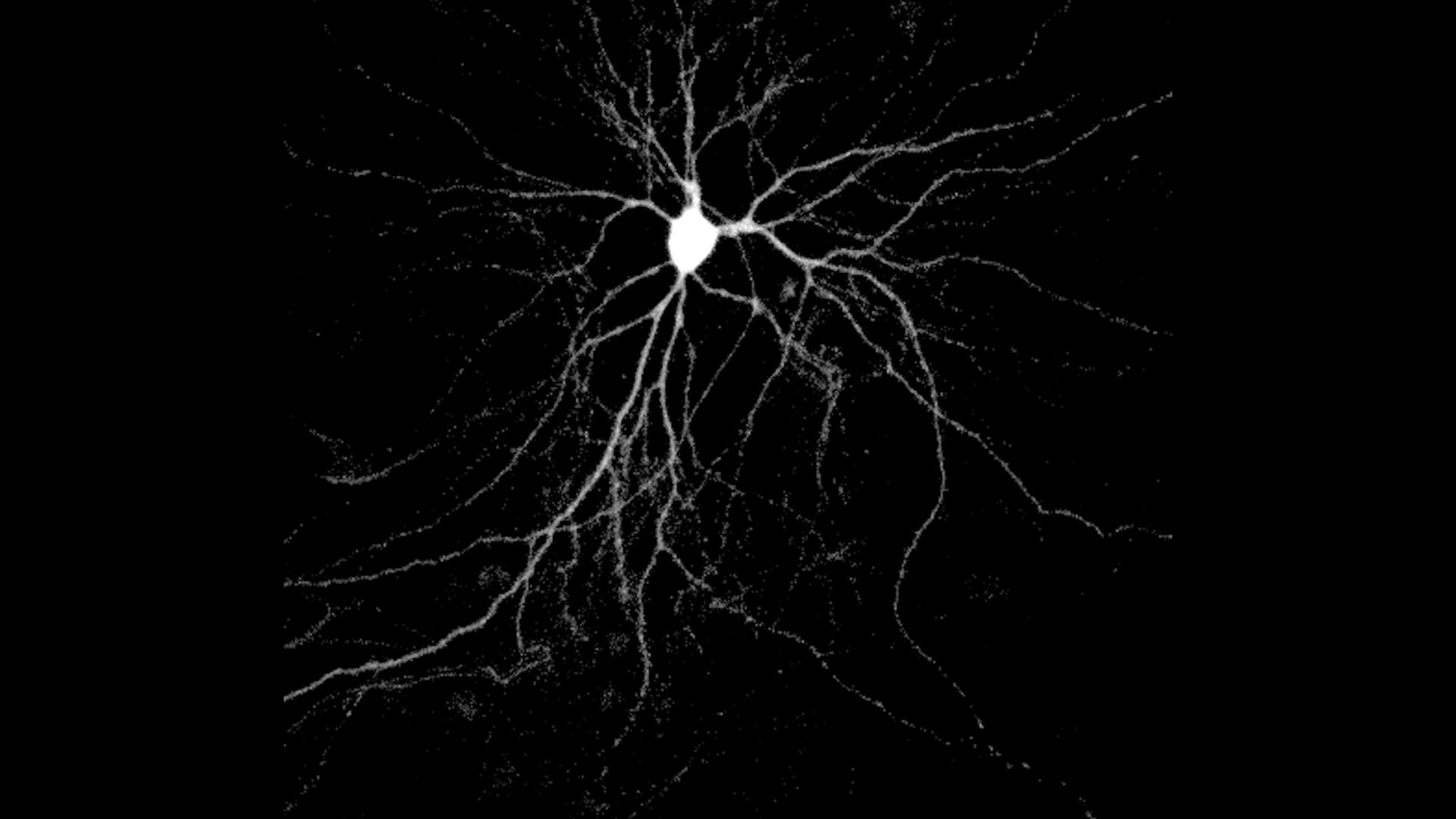 Científicos de Estados Unidos descubrieron que la proteína cerebral Arc transporta la Tau tóxica entre neuronas y acelera el avance del Alzheimer ( Mitali Tyagi)