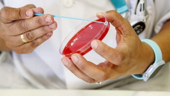 La OMS lanza CoViNet, una red global para el estudio de los coronavirus