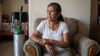 Mujer sentada en un sillón con una cánula nasal, conectada a un tubo de oxígeno y un tanque de oxígeno con manómetro. Fondo con televisor y muebles.