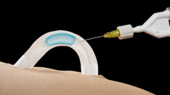 El método podría ayudar a