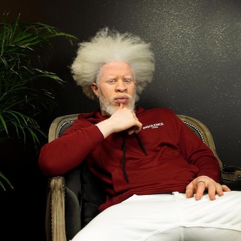 El francés de origen congoleño,