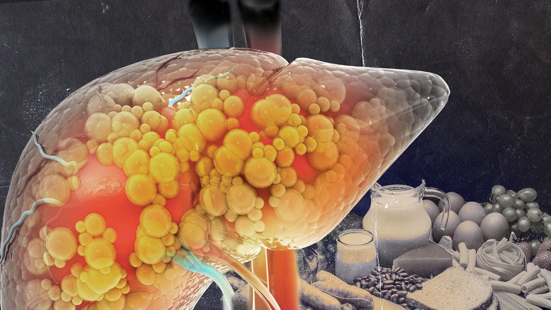 Acompañado de un cambio de hábitos el consumo de búlgaros puede tener un impacto positivo. (Foto: Infobae México/ Jesús Avilés)