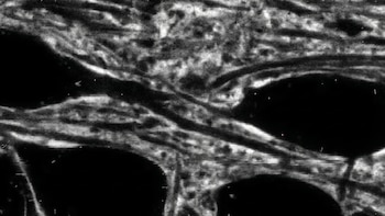 El espacio entre las neuronas puede influir en tu rapidez cerebral: un estudio confirma que estos “huecos” son partes activas del sistema.