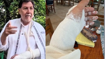 Fernández Noroña sale del IMSS con la muñeca enyesada tras accidente en la montaña