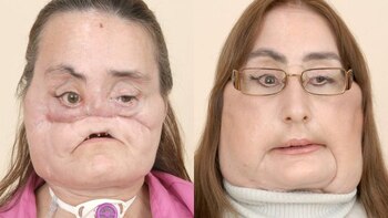 Murió Connie Culp, la mujer