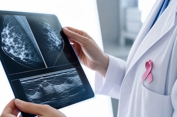 Un profesional de la salud sujetando con delicadeza una placa de mamografía y ecografía transparente frente a una pantalla de luz blanca limpia