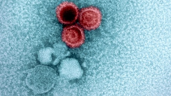 Investigadores de Harvard revelan por qué algunos virus persisten en el cuerpo toda la vida
