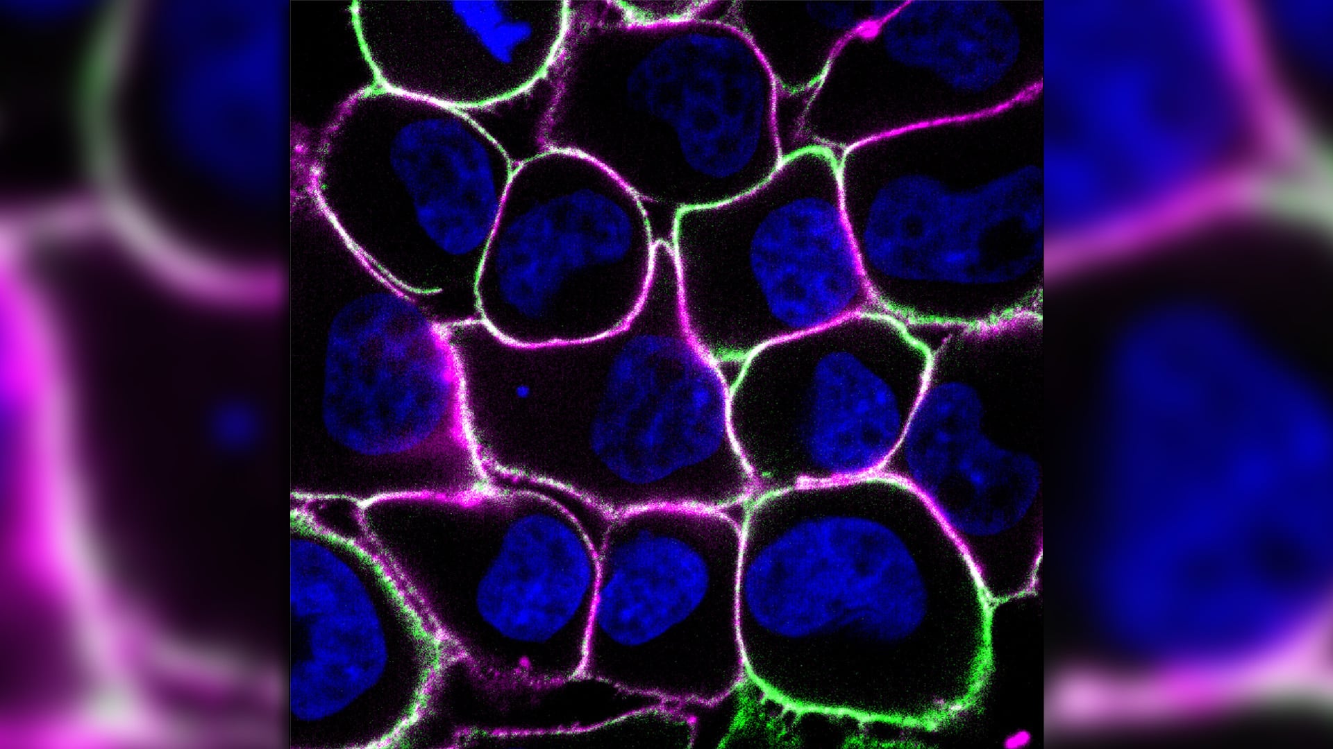Descubrieron que el ayuno activa receptores de glucocorticoides en tumores de mama hormonodependientes (Carmona-Fontaine Nature tumor cells)