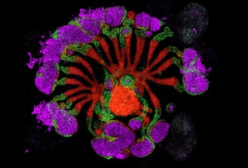 Un ensamblaje de tejido renal