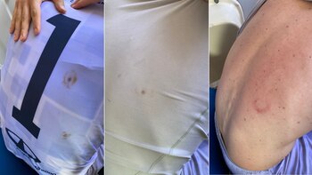 arquero tristan suárez bengala